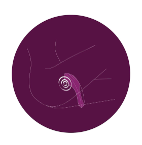 Pulse Queen diagram of use